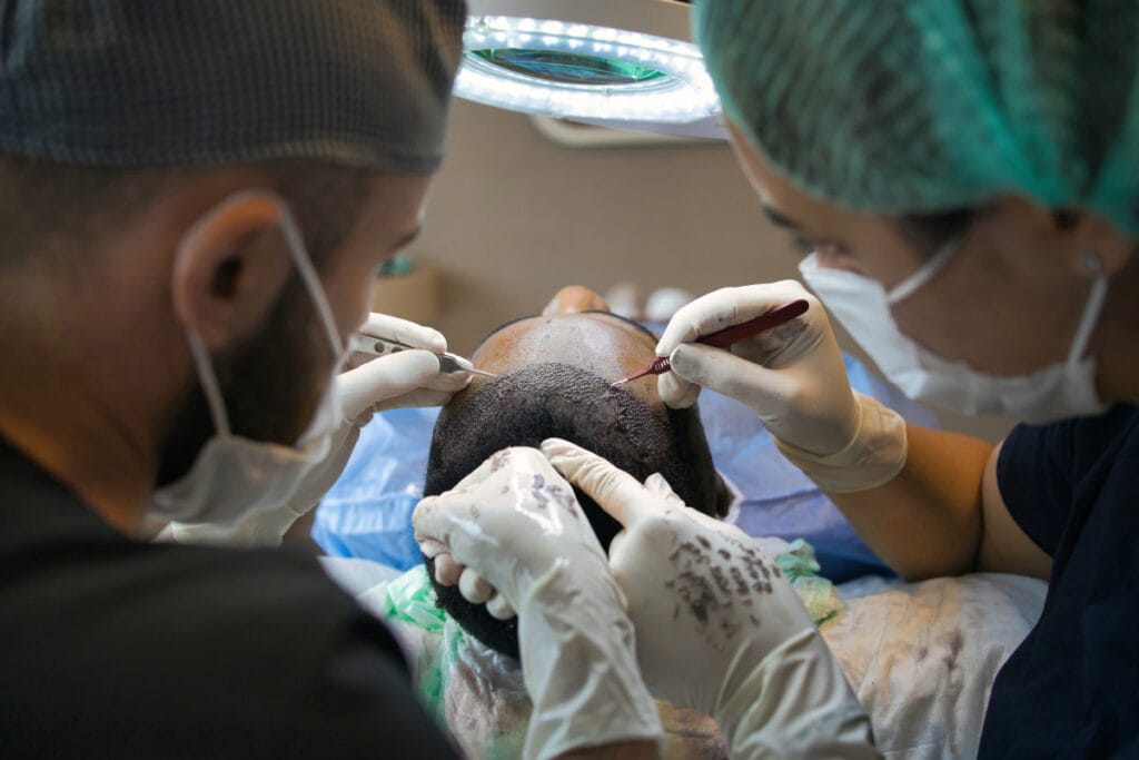 Two surgeons performing a hair transplant procedure