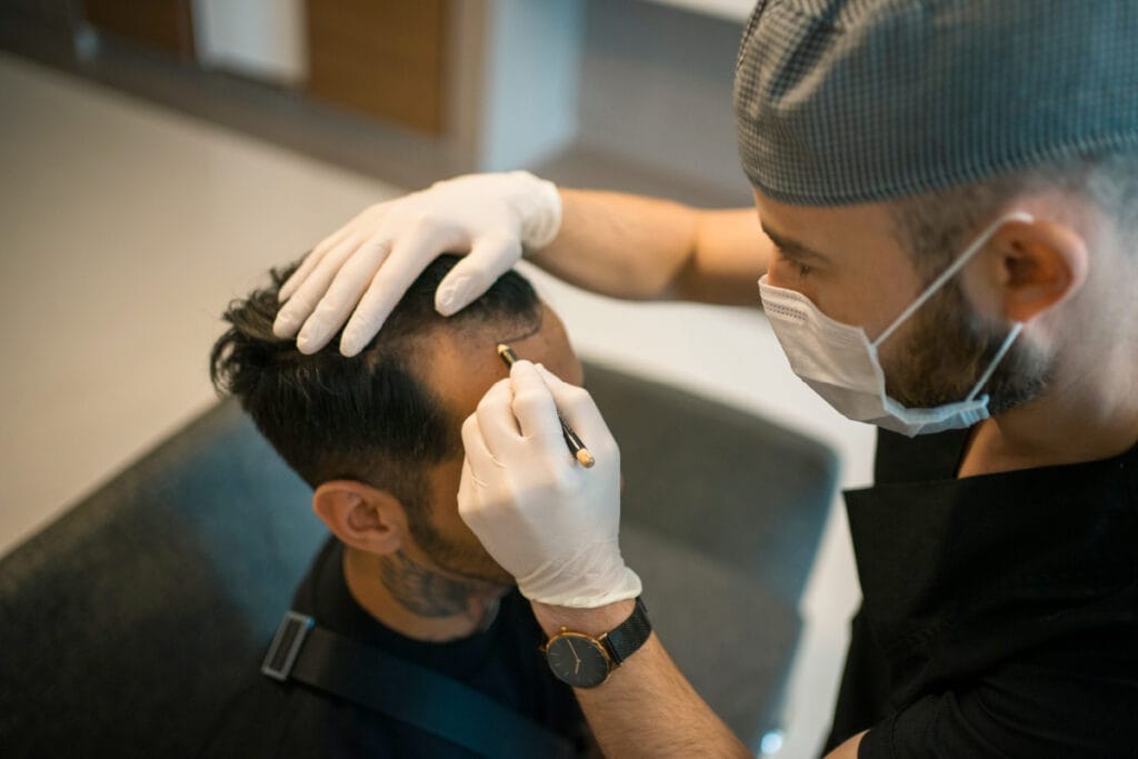 Man getting marked on by surgeon during hair transplant consultation